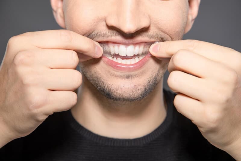Do Whitening Strips Work for Yellow Teeth?