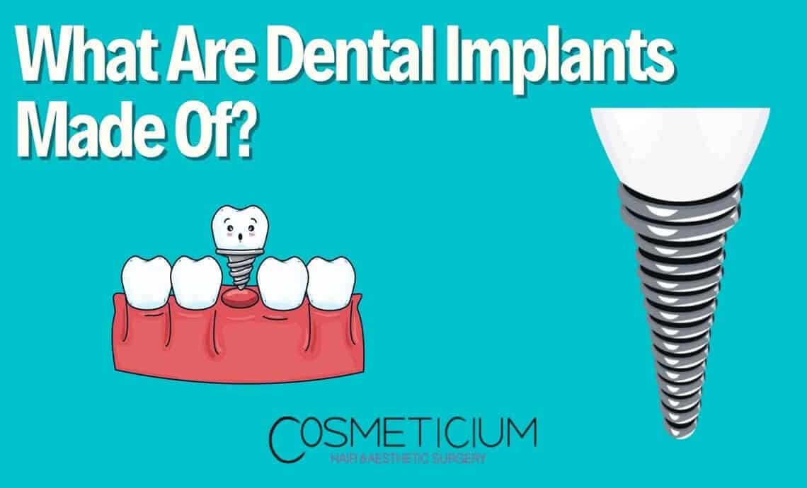 What Are Dental Implants Made Of? Learn These 5 Materials!