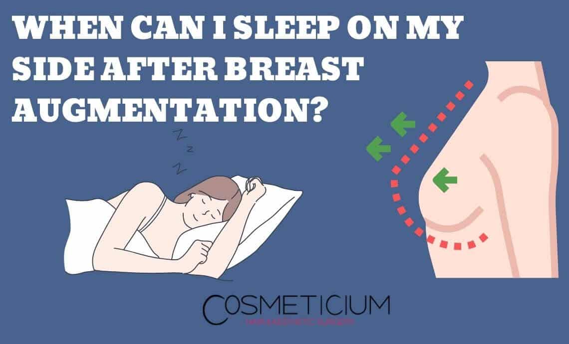 When Can I Sleep on My Side After Breast Augmentation?