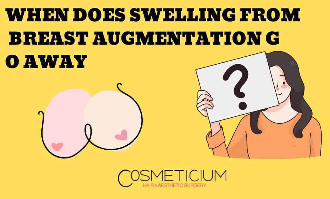 When Does Swelling From Breast Augmentation Go Away?