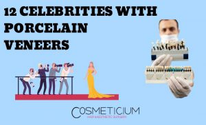 Celebrities with Porcelain Veneers