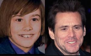Jim Carrey Dental Veneers