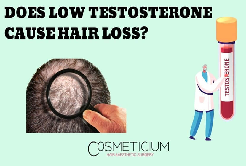 Does Low Testosterone Cause Hair Loss? Here’s What to Do!