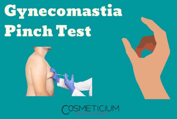 Gynecomastia Pinch Test FAQS