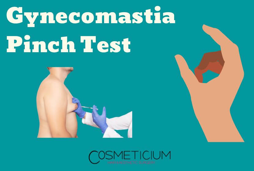 How Do I Know If I Have Gynecomastia Do Your Pinch Test 