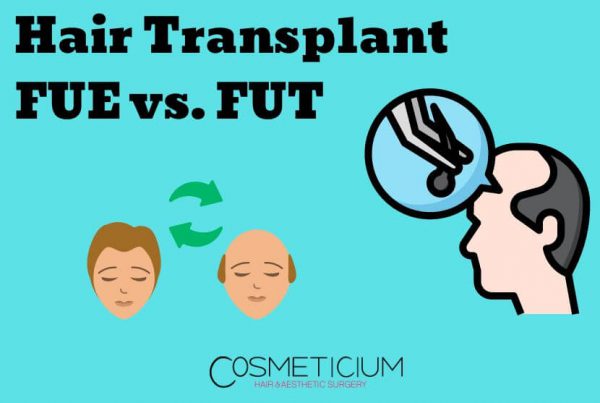 Hair Transplant Methods FUE and FUT Comparison