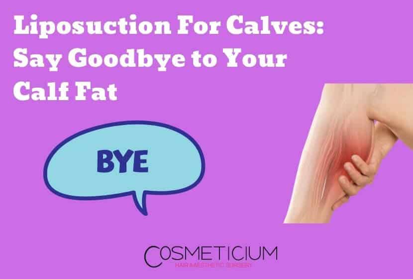 Liposuction For Calves: Say Goodbye To Your Calf Fat