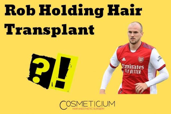 Rob Holding Hair Transplant
