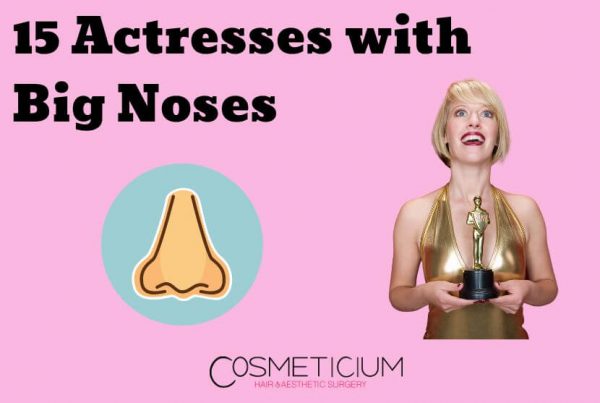 Actresses With Big Noses