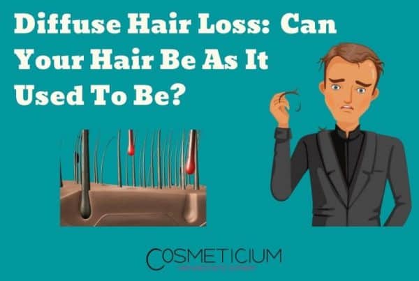 Diffuse Hair Loss | Can Your Hair Be as It Used to Be?