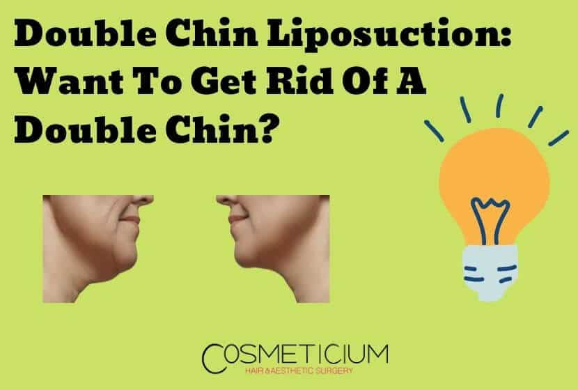 Double Chin Liposuction: Want To Get Rid Of A Double Chin?