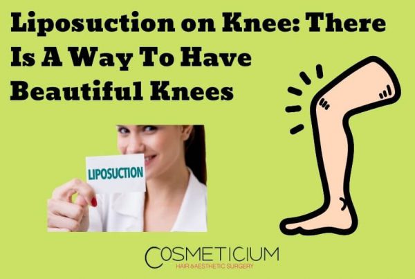 Liposuction on Knee