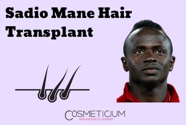 Sadio Mane Hair Transplant