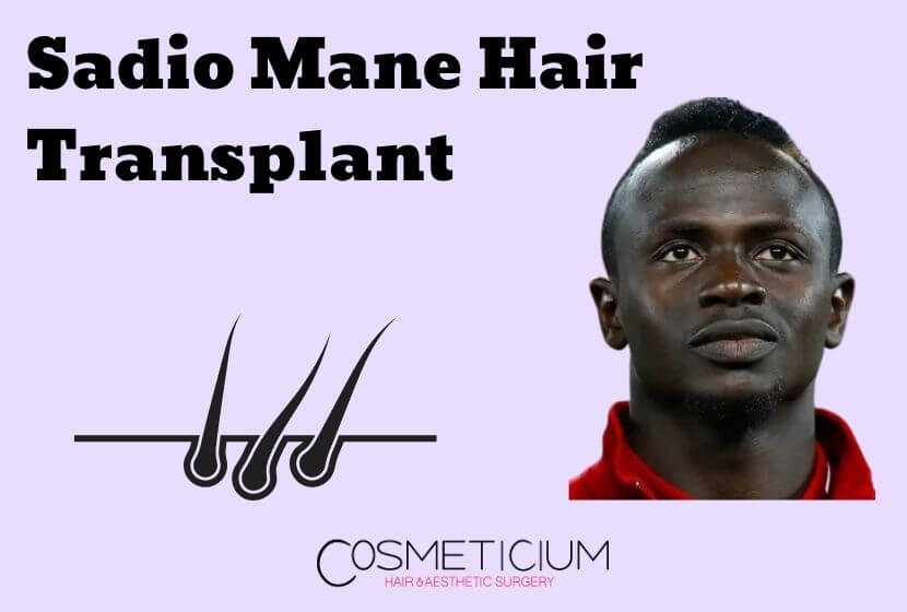 Sadio Mane Hair Transplant | Rumor or Real?