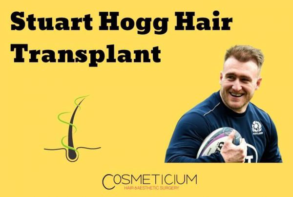Stuart Hogg Hair Transplant