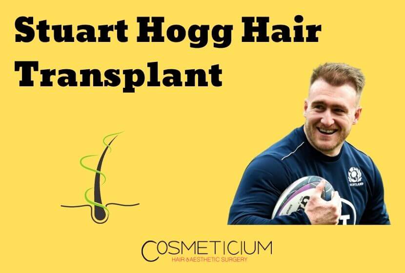 Stuart Hogg Hair Transplant | Impressive Look with New Hair