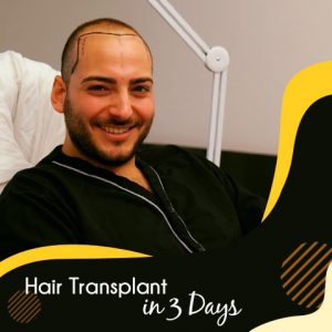 Cosmeticium Hair Transplant