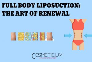 Full Body Liposuction: The Art of Renewal from Top to Bottom