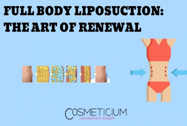 Full Body Liposuction: The Art of Renewal from Top to Bottom