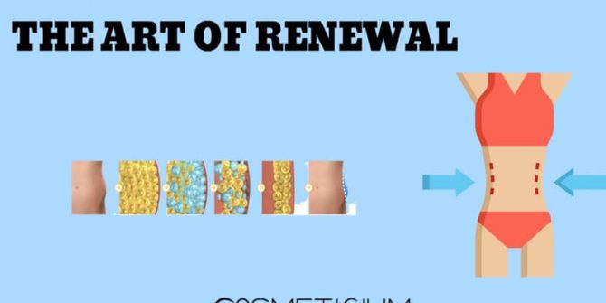 Full Body Liposuction: The Art of Renewal from Top to Bottom