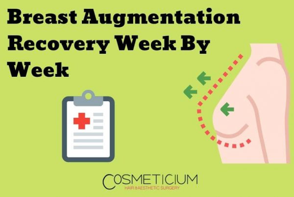 Breast Augmentation Recovery Week By Week: Amazing Results