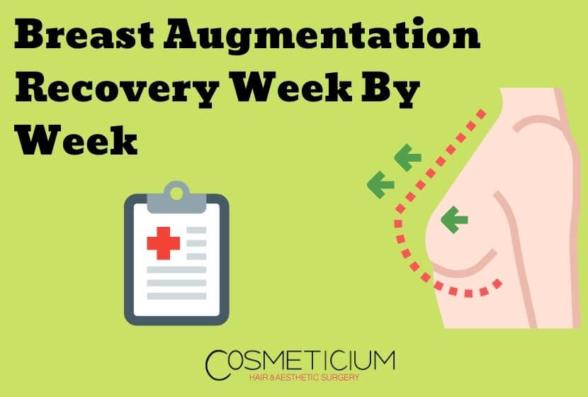 Breast Augmentation Recovery Week By Week: Amazing Results