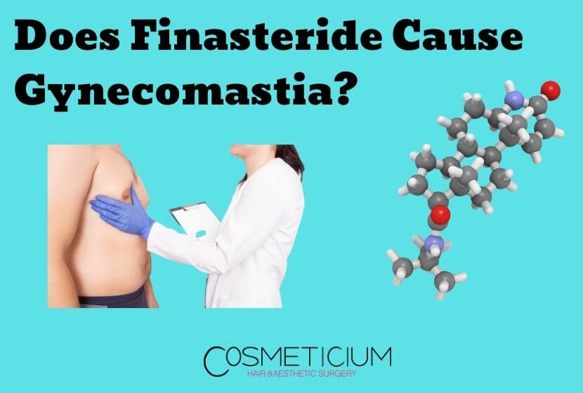 Does Finasteride Cause Gynecomastia? | Here Are Warning Signs