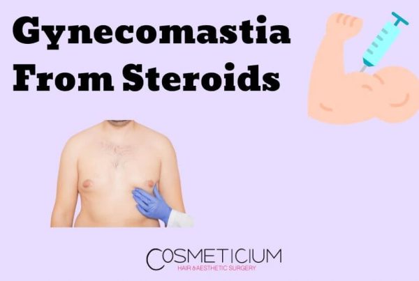 What You Should Know About Gynecomastia From Steroids?