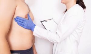 Finasteride-induced gynecomastia