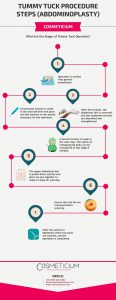 tummy-tuck-procedure-steps-infographic