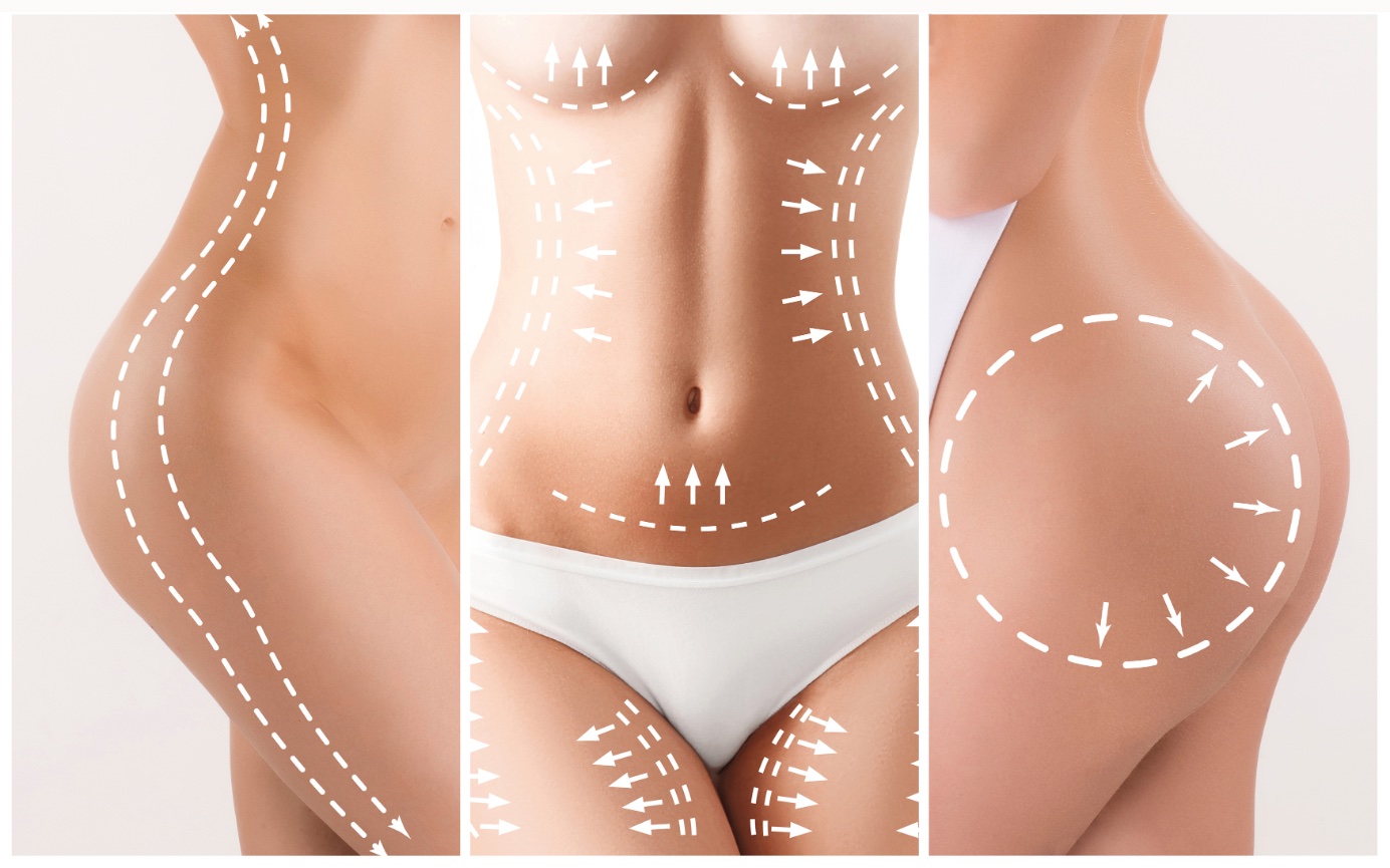 Breast Implants Versus Fat Transfer: Pros and Con