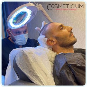 Cosmeticium-DHI-Hair-Transplant-in Turkey examining hair by doctor Batu