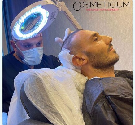 hair transplant istanbul hair loss
