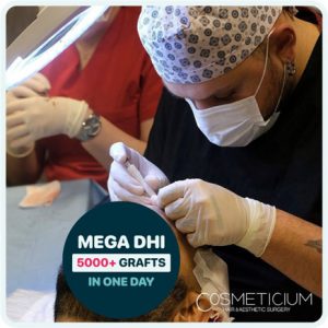 Cosmeticium-DHI-Hair-Transplant-Process operation by doctor Batu