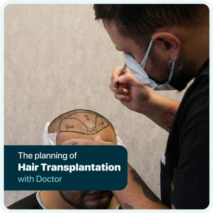 Cosmeticium-DHI-Hair-Transplant-operation in Turkey draw hairline by doctor Batu