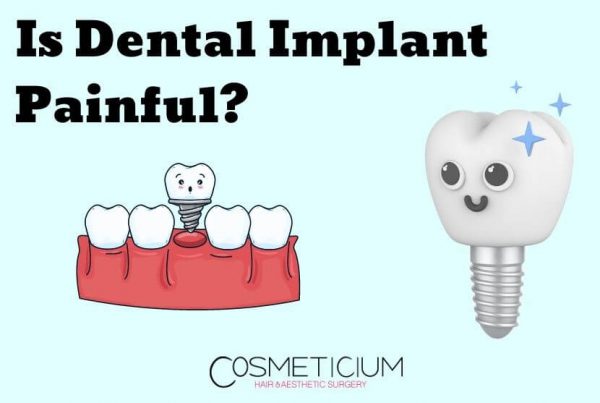 Is Dental Implant Painful? Learn Pain Level Before You Decide!