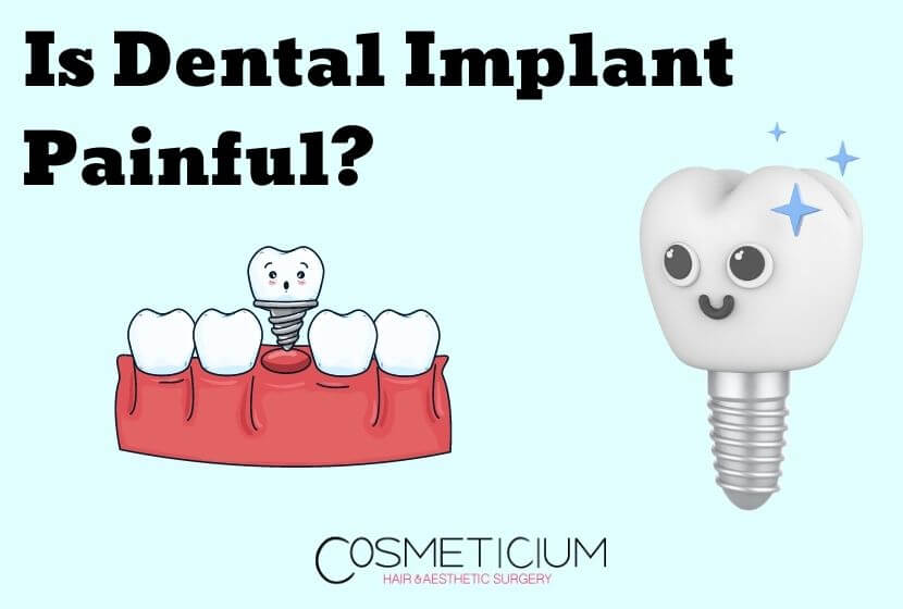 Is Dental Implant Painful? Learn Pain Level Before You Decide!