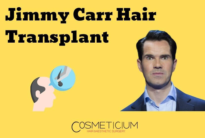 Jimmy Carr Hair Transplant | Discover His Glamorous Look