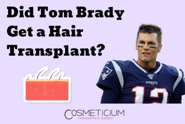Tom Brady Hair Transplant