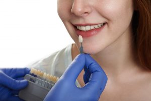 Dental Crowns 2