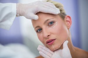 Eyelid Surgery Dark Circle