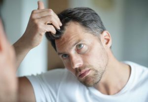 smoking-and-hair-loss-photo-1_d.jpg