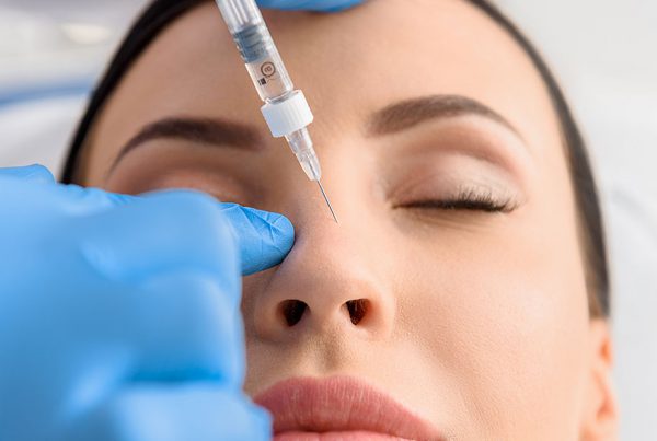 Rhinoplasty
