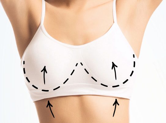 Breast Lift