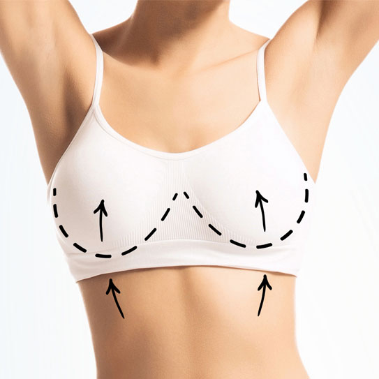 Breast Lifts: How Long Will Your Results Last?