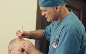 Hair Transplant