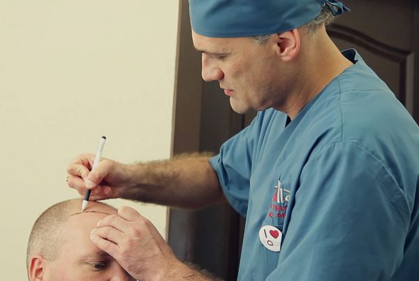 Hair Transplant