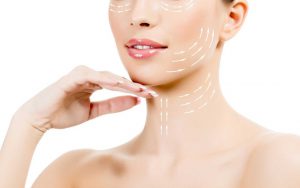 Neck Lift