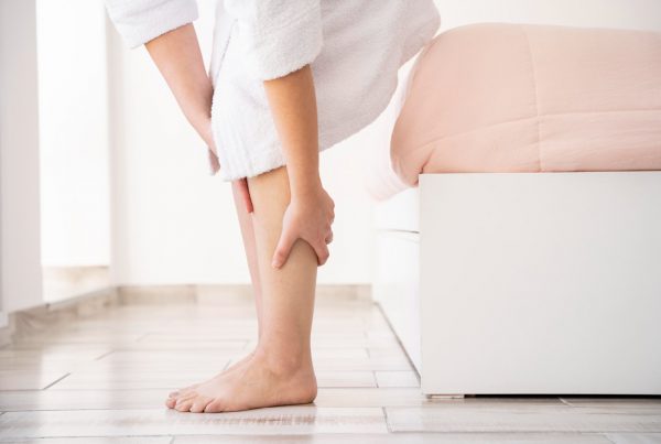 Vericose Veins