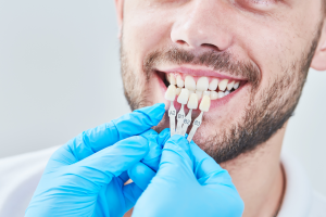 Dental Crowns